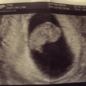 Meet your Posher, Sky-lynn